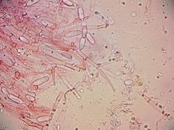 mycoph60-0037.thumb.jpg.0853201ff4733af9514d303d70e41587.jpg