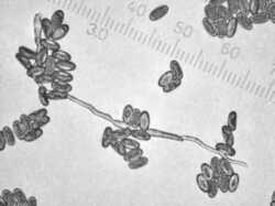 Peziza_violacea_3_spores400_SAE_20080616.thumb.jpg.132683873f36d4452b9fa388084a4233.jpg