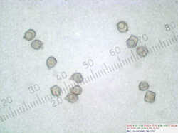 Entoloma_sp_spores500_SAE_20101012.jpg