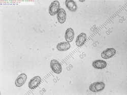 Peziza_sp_spores500_2_SAE_20240702.thumb.jpg.dfaa1805b74ca3357b8b90ec2a53646b.jpg