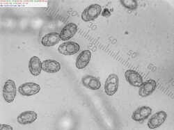 Peziza_sp_spores500_3_SAE_20240702.thumb.jpg.e5eed13c64f348ef99bfae015df85c92.jpg