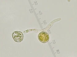 Puccinia_magnusiana_spores500amm_1_SAE_20250625.thumb.jpg.d16edd993a8a9000bfcb9b802264ef25.jpg