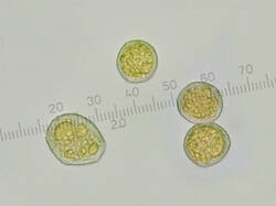 Puccinia_magnusiana_spores500amm_2_SAE_20250625.thumb.jpg.d27f0a6712342cab4a93f66c453e53fd.jpg