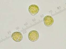 Puccinia_magnusiana_spores500amm_3_SAE_20250625.thumb.jpg.ad9ca765b4c9e32b01bede33b03e763d.jpg