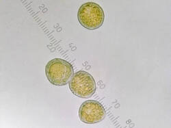 Puccinia_magnusiana_spores500amm_4_SAE_20250625.thumb.jpg.de9abf551cb815b8a6189197d4d7c79e.jpg