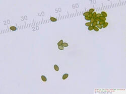 Coprinus_sp_spores500amm_1_SAE_20251218.thumb.jpg.f4765a7a415b8c49e6445860af766609.jpg