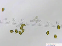 Fungus_sp_spores500water_SAE_20260609.thumb.jpg.871c6516286b6bccccb0c9d3936dd15b.jpg