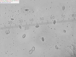Hertzogia_martiorum_spores500amm_SAE_20260609.thumb.jpg.e96df3af6bda09c4cc7718f01fc17f10.jpg