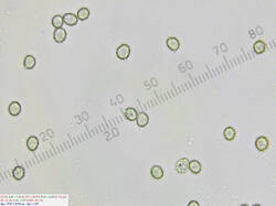 Russula_nitida_spores500water_1_SAE_20260609.thumb.jpg.ed99996dd62eef2fd4271cf531e361fc.jpg