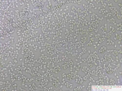 White_fungus_spores500amm_SAE_20260609.thumb.jpg.776471c5644278431a3521fe81a84a6f.jpg