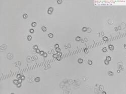 Lyophyllum_sp_spores500amm_SAE_20260115.thumb.jpg.afb591e68a9a4e56c600d20389dfbf55.jpg