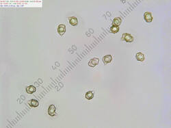 Entoloma_sp_spores500amm_SAE_20260617.thumb.jpg.9c6a5f82da2b13c816a00945fa573da9.jpg