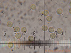 Lycogala_sphaeroconicum_AYV_20260908_01.jpg