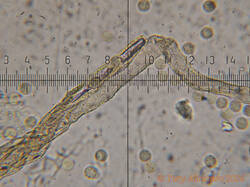 Lycogala_sphaeroconicum_AYV_20260908_02.jpg