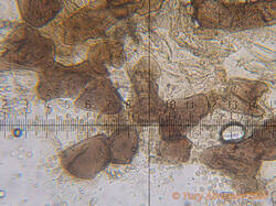 Lycogala_sphaeroconicum_AYV_20260908_03.jpg